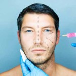25 фактов о пластической хирургии